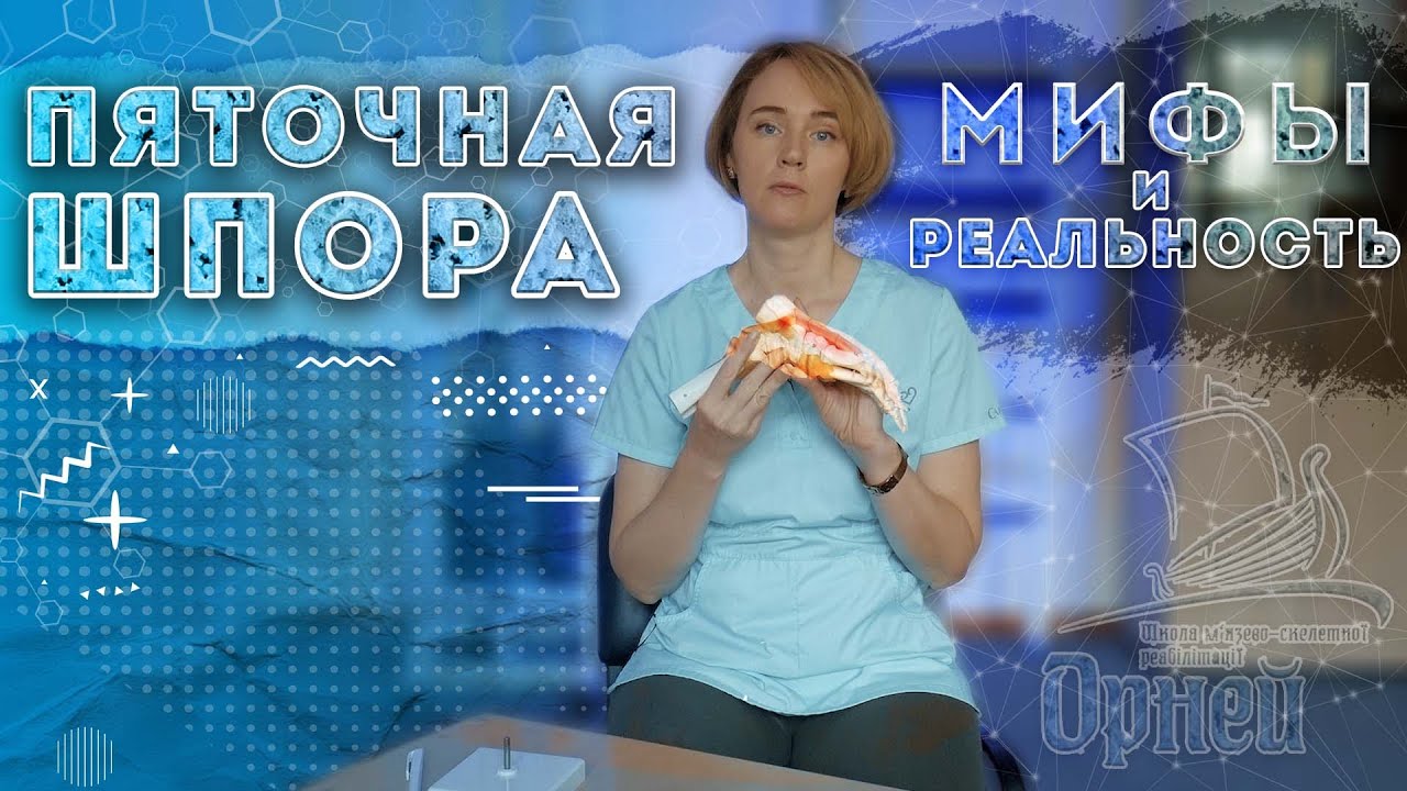 ПЯТОЧНАЯ ШПОРА  | МИФЫ И РЕАЛЬНОСТЬ