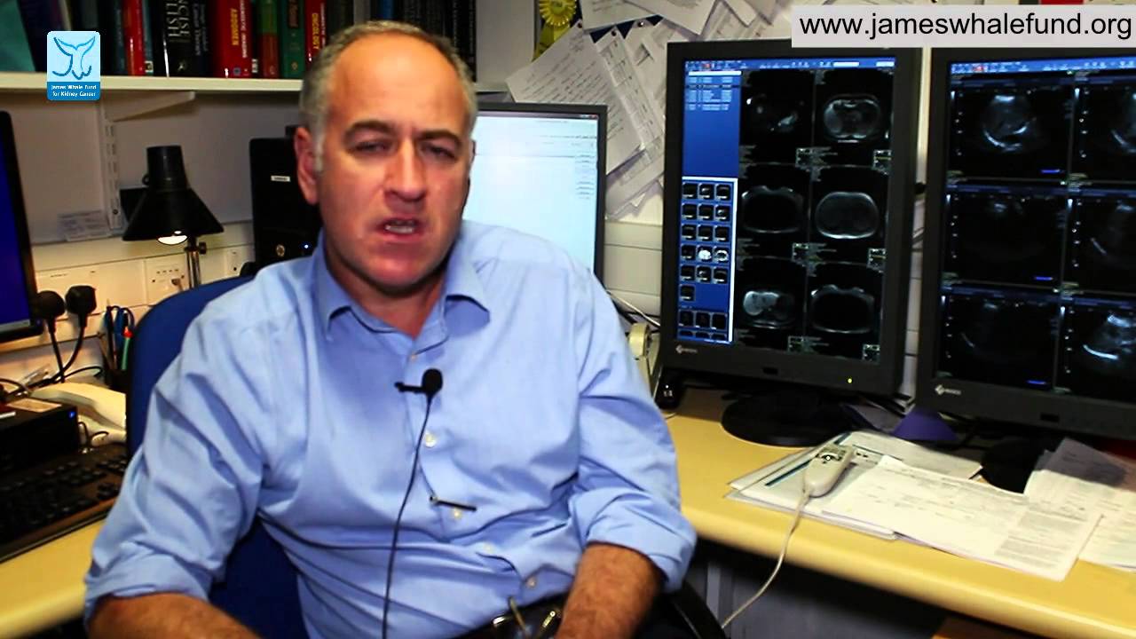 Kidney Cancer - Cryoablation for renal tumours