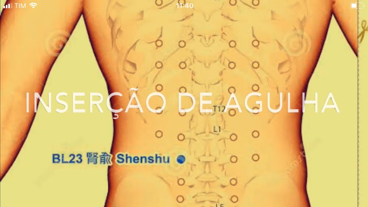 B23 - Shenshu