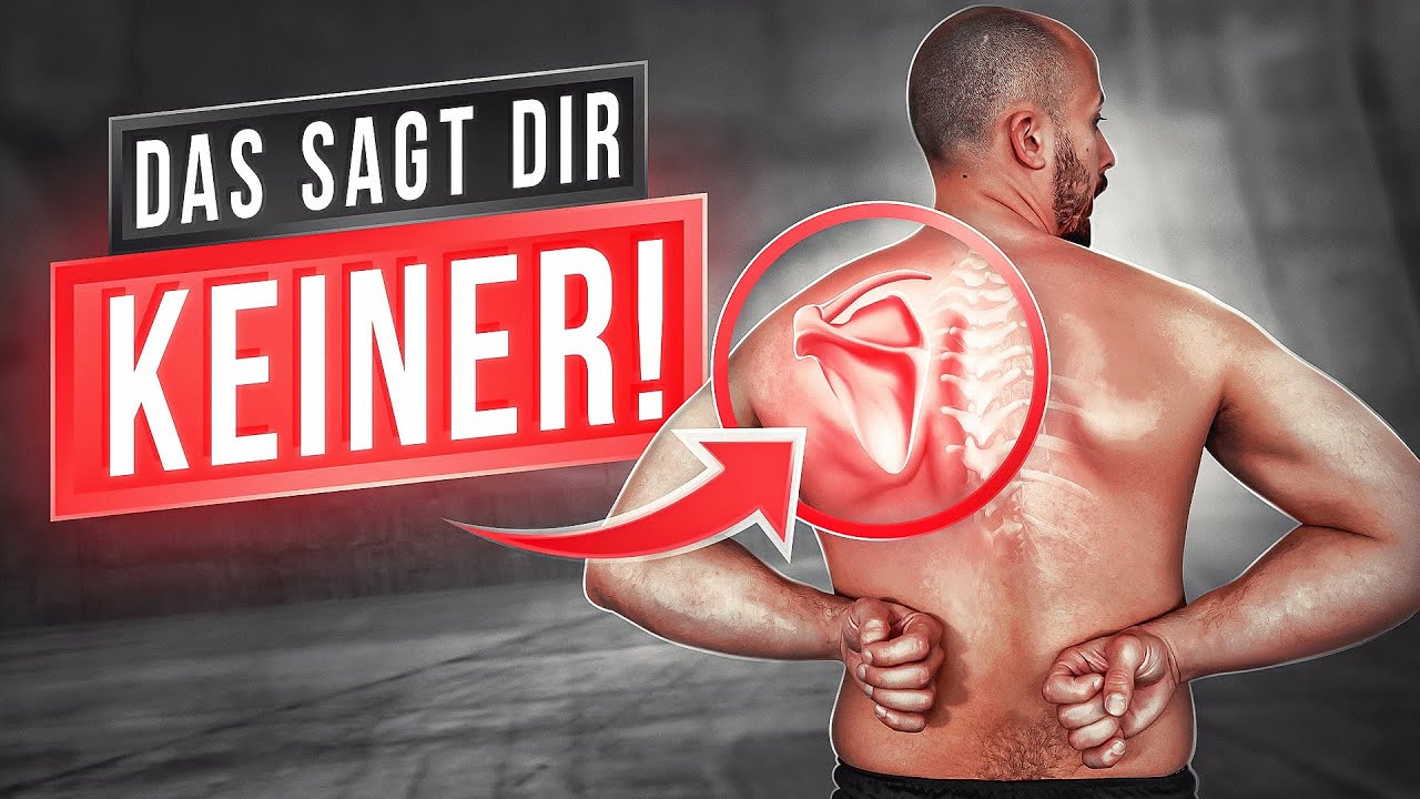 Scapula Alata (Engelsflügel) korrigieren | DAS weiß fast keiner!