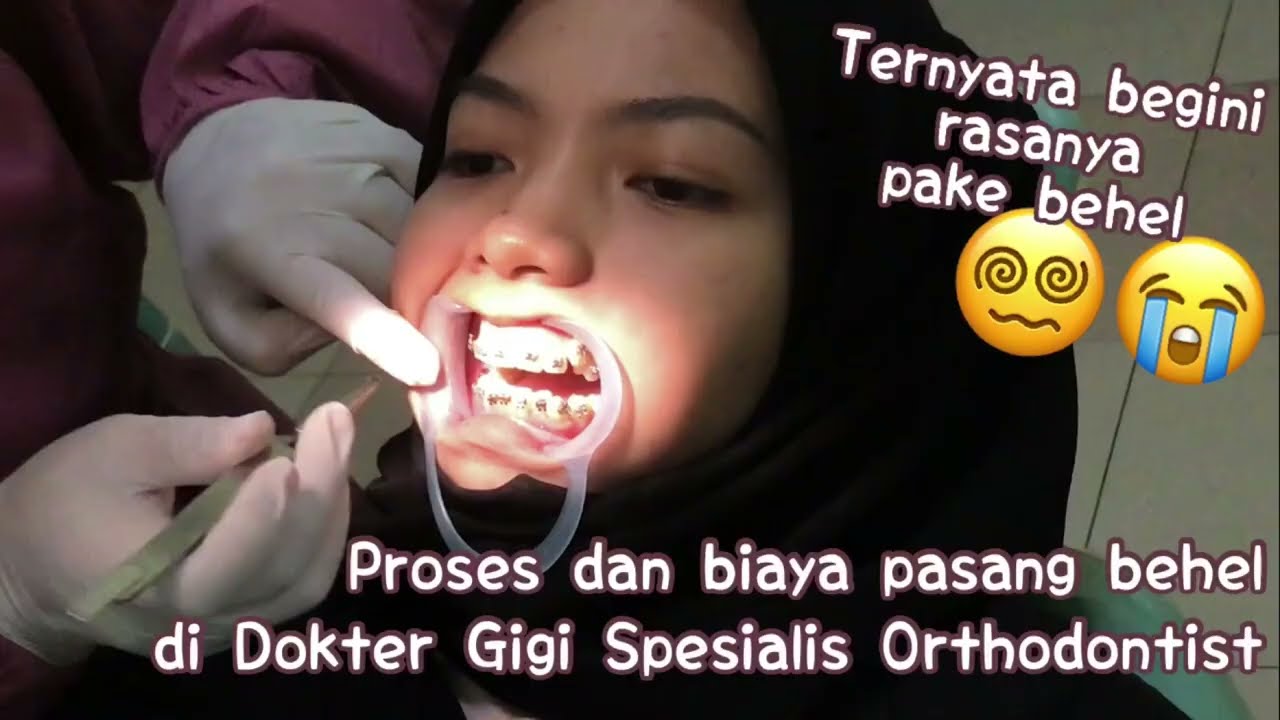 PENGALAMAN PASANG BEHEL | PROSES & BIAYA TAHUN 2021 | Vlog #2