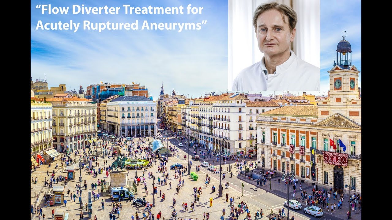 Flow Diverter Treatment for Acutely Ruptured Aneurysms