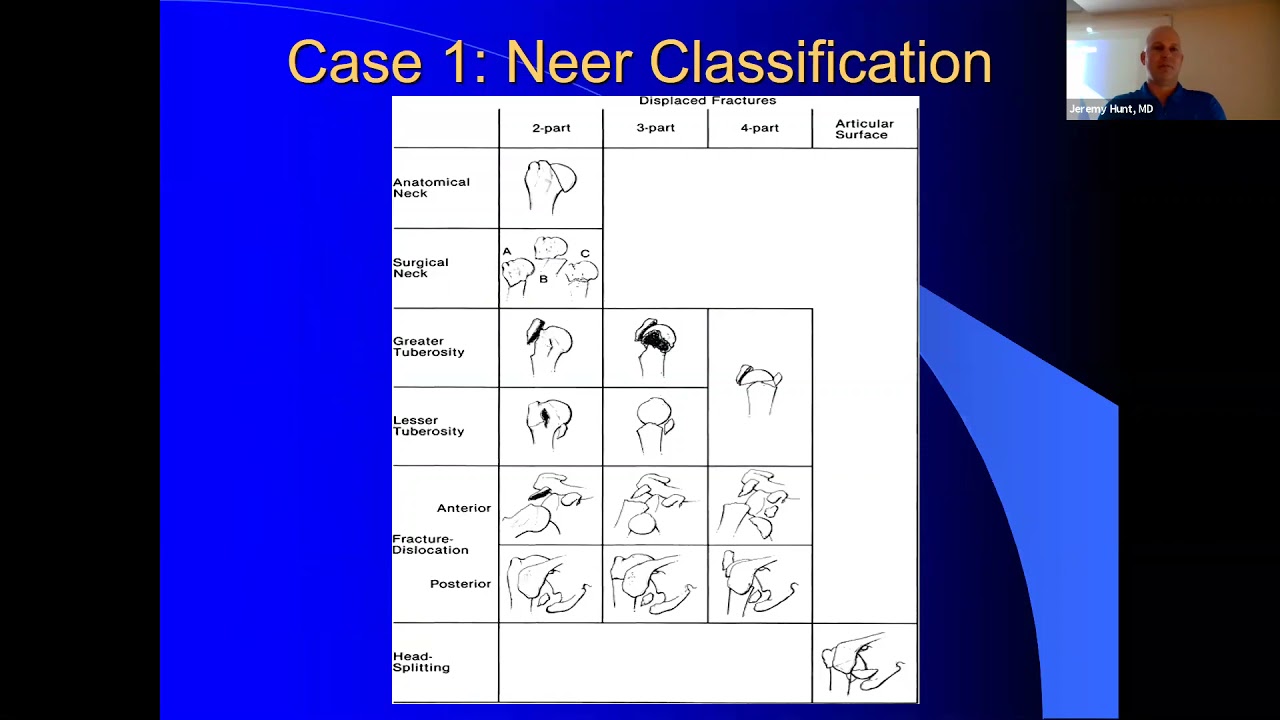 Athlete's Shoulder Part 2  - Dr. Hunt