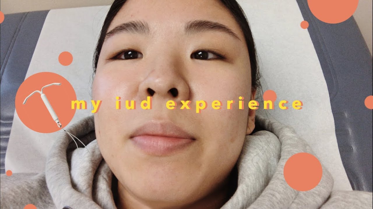 My IUD Experience - Things to Know
