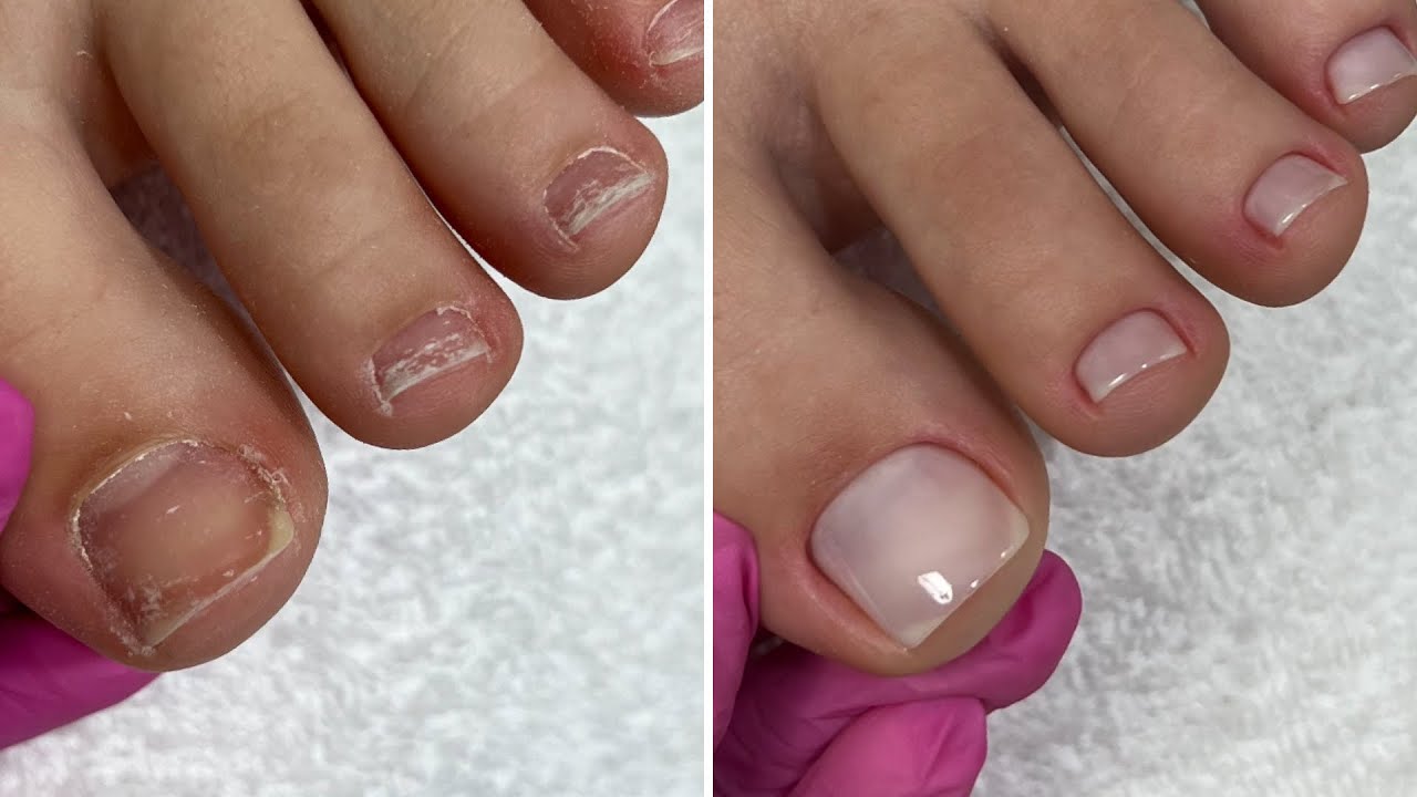 CUTILAGEM E ESMALTAÇÃO DAS UNHAS DOS PÉS 🤤