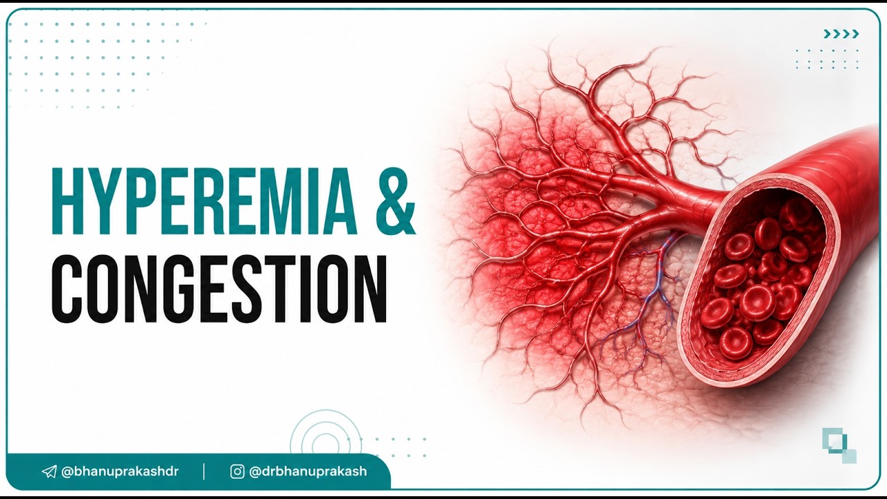 Hyperemia & Congestion Animation: Pathology Lectures