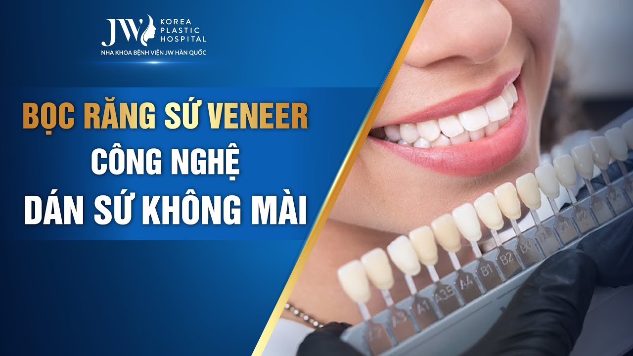 Bọc Răng Sứ Veneer JW - Công Nghệ Dán Sứ KHÔNG MÀI (Chuẩn Quốc Tế)