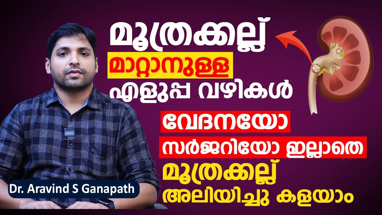 മൂത്രക്കല്ല് മാറ്റാനുള്ള എളുപ്പ വഴികൾ | വേദനയോ സർജറിയോ ഇല്ലാതെ Kidney Stone അലിയിച്ചു കളയാം