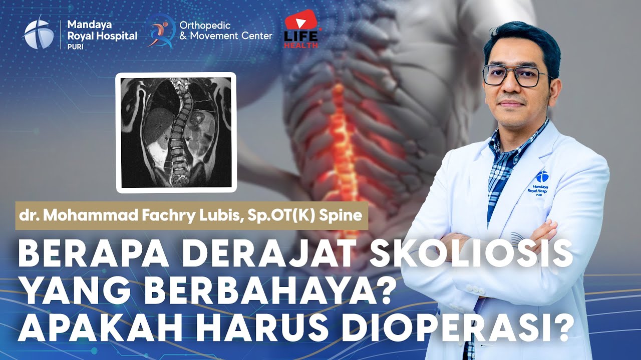 Minimal Derajat Skoliosis yang Perlu Dioperasi | dr. M. Fachry Lubis, Sp.OT(K) Spine