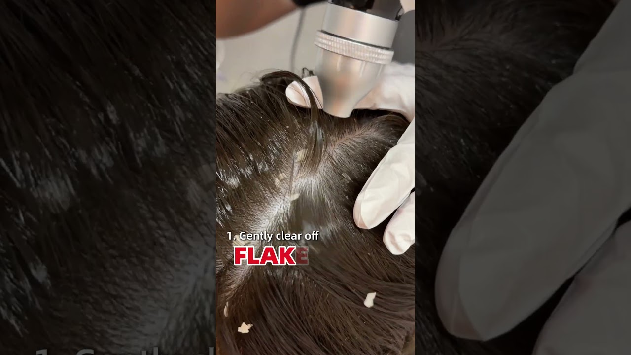 Flakes? Itch? Dry scalp drama? 😩