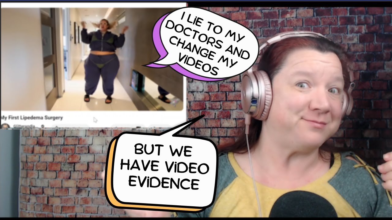 Anna's Surgery Docu-series is Really Sus, and Her Threads are Raising Questions.