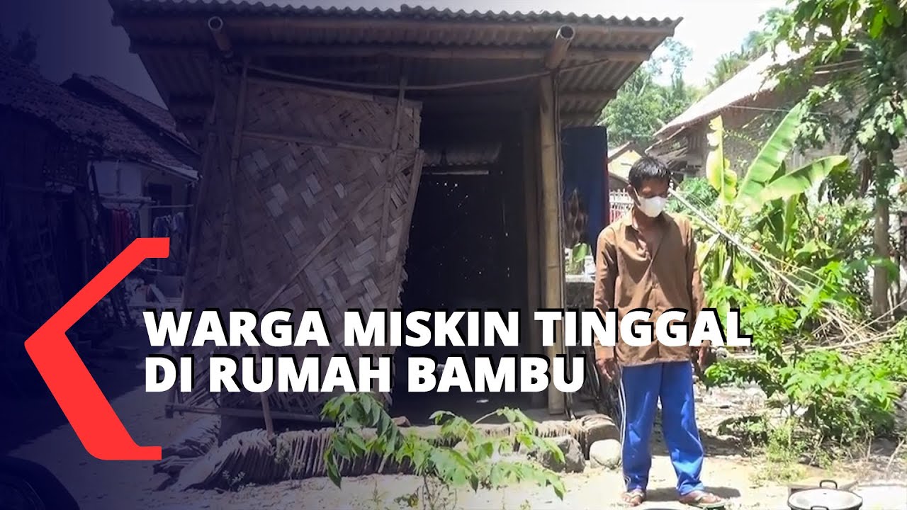 Warga Miskin Hidup Sendiri di Rumah Bambu dengan Kaki Patah