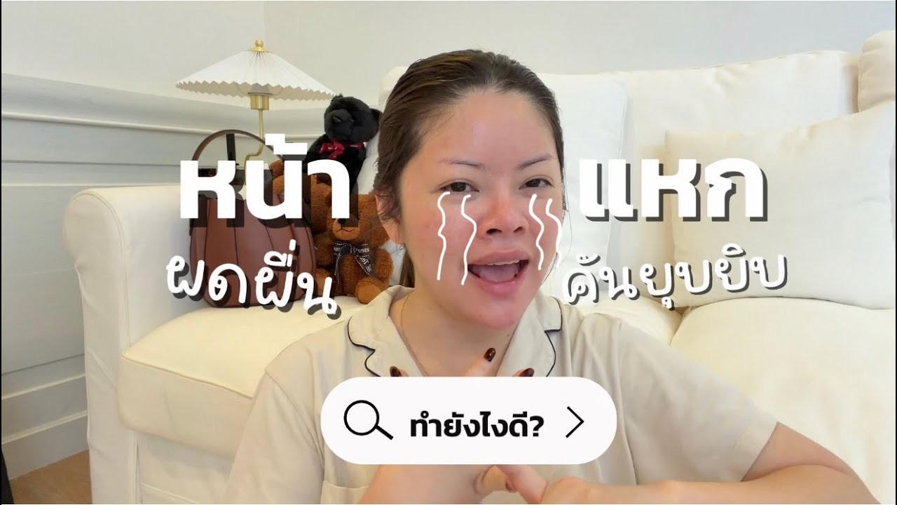 ผดผื่นคันขึ้นทั้งหน้า ต้องทำยังไง ใช้อะไรดี?