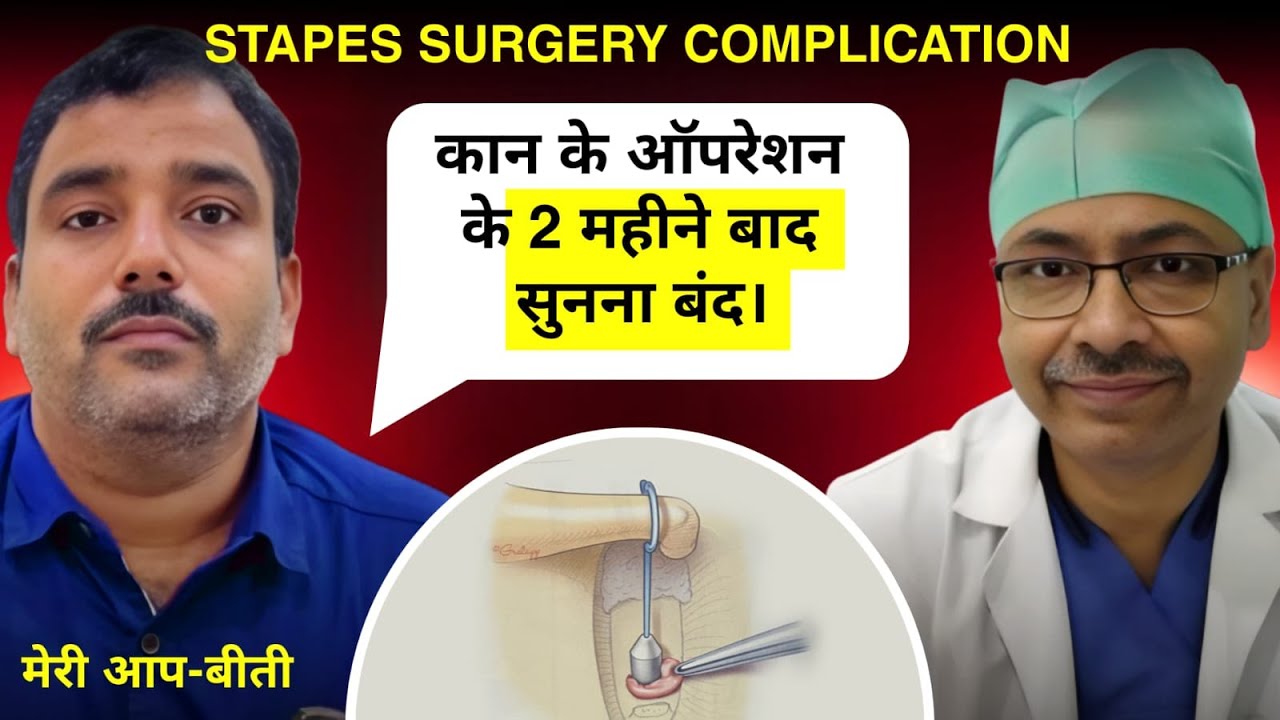 Stapedotomy: सुनने का जादुई ऑपरेशन पर ?? Otosclerosis