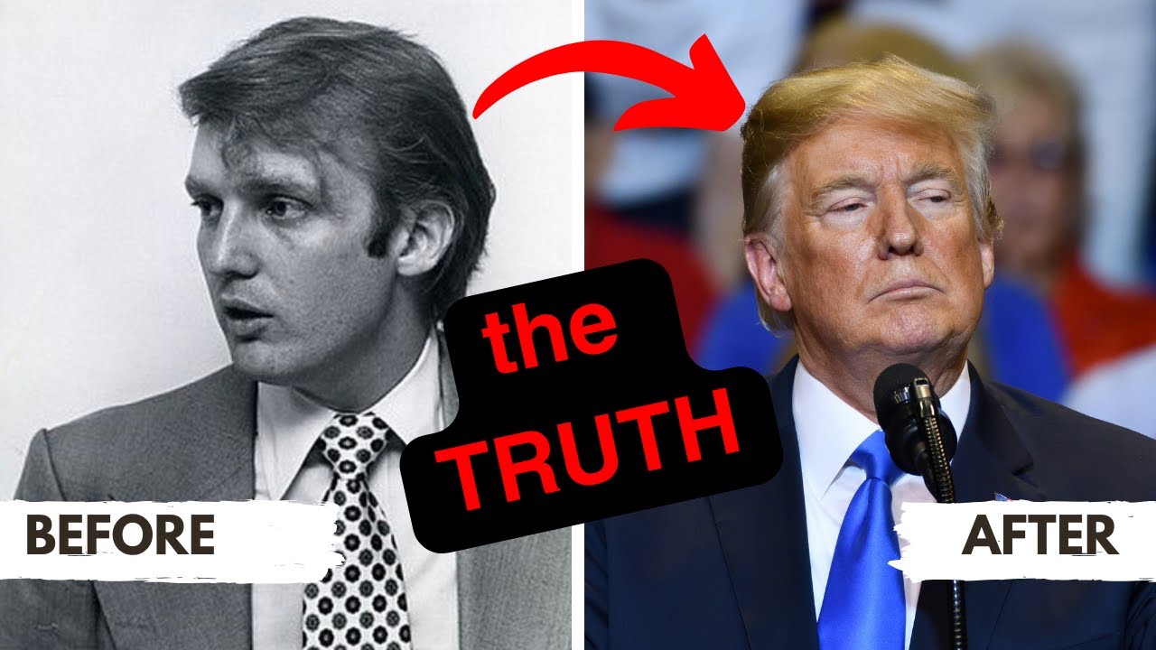 Donald Trump's Hair Secrets Exposed!