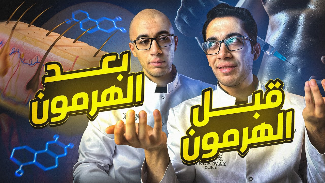 الهرمونات و الصلع l ازاي تحافظ علي شعرك قبل فوات الأوان !