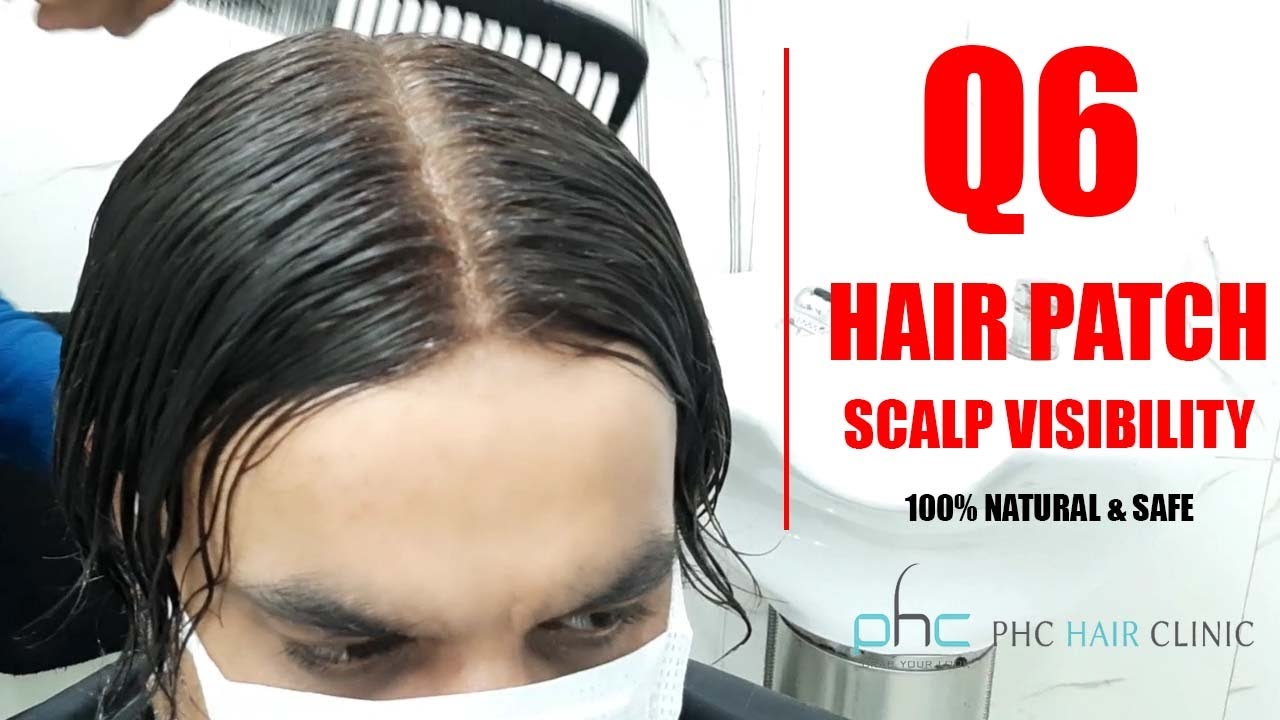 Best Q6 Hair Patch [Wig] video in india superb stylish look by Planet of Hair Cloning +91 9899746489