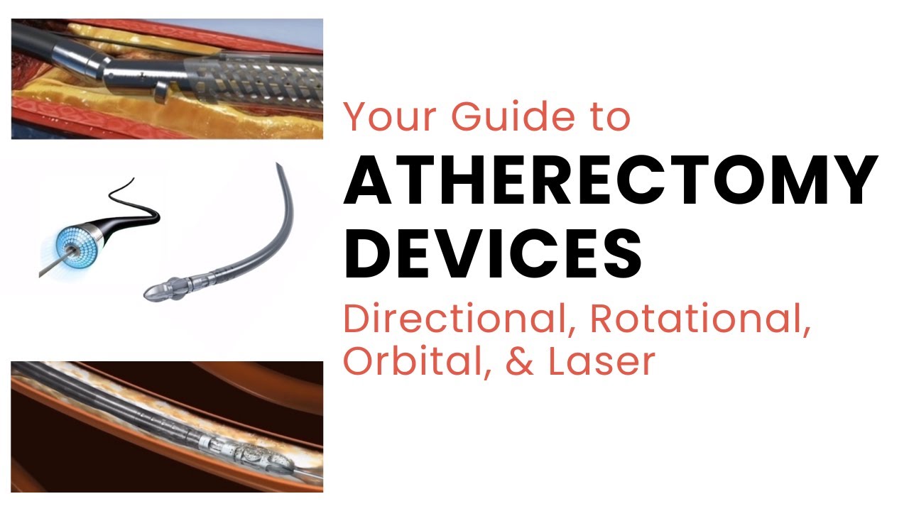 Your Guide to Atherectomy Devices! | Directional, Rotational, Orbital, & Laser
