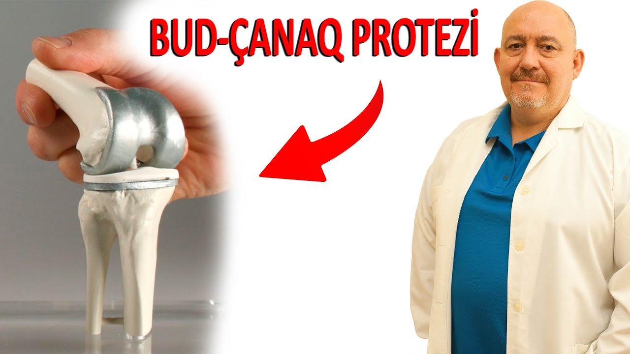 Bud-Çanaq Artrozu - Protez nə vaxt qoyulur?