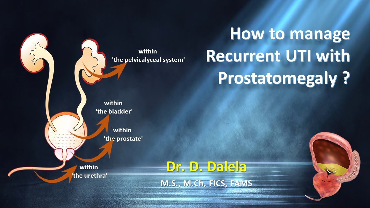 How to manage Recurrent UTI with Prostatomegaly ?