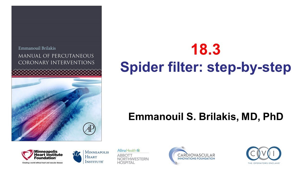 18.3 Spider filter: step-by-step - Manual of PCI