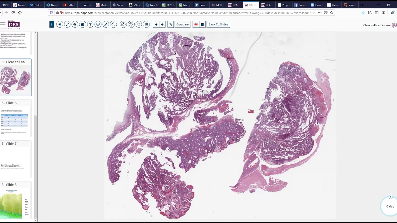 Digital Surgical Pathology 30