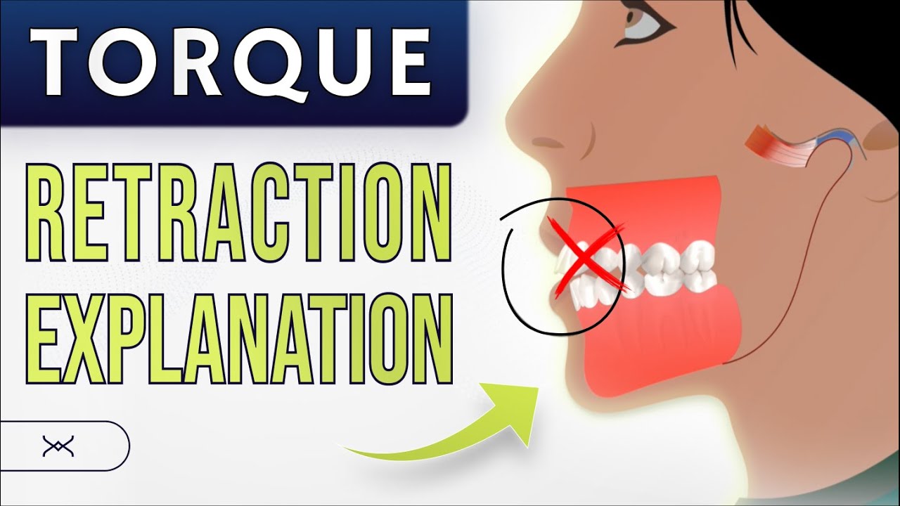 TORQUE - Retraction Explanation