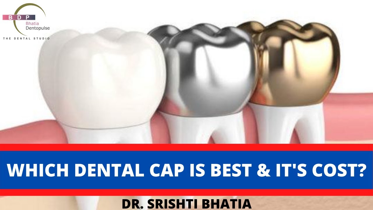 Types of teeth caps, What's Best & it's Cost? जानिए कौनसा टूथ कैप सबसे बेस्ट है? Dr. Srishti Bhatia