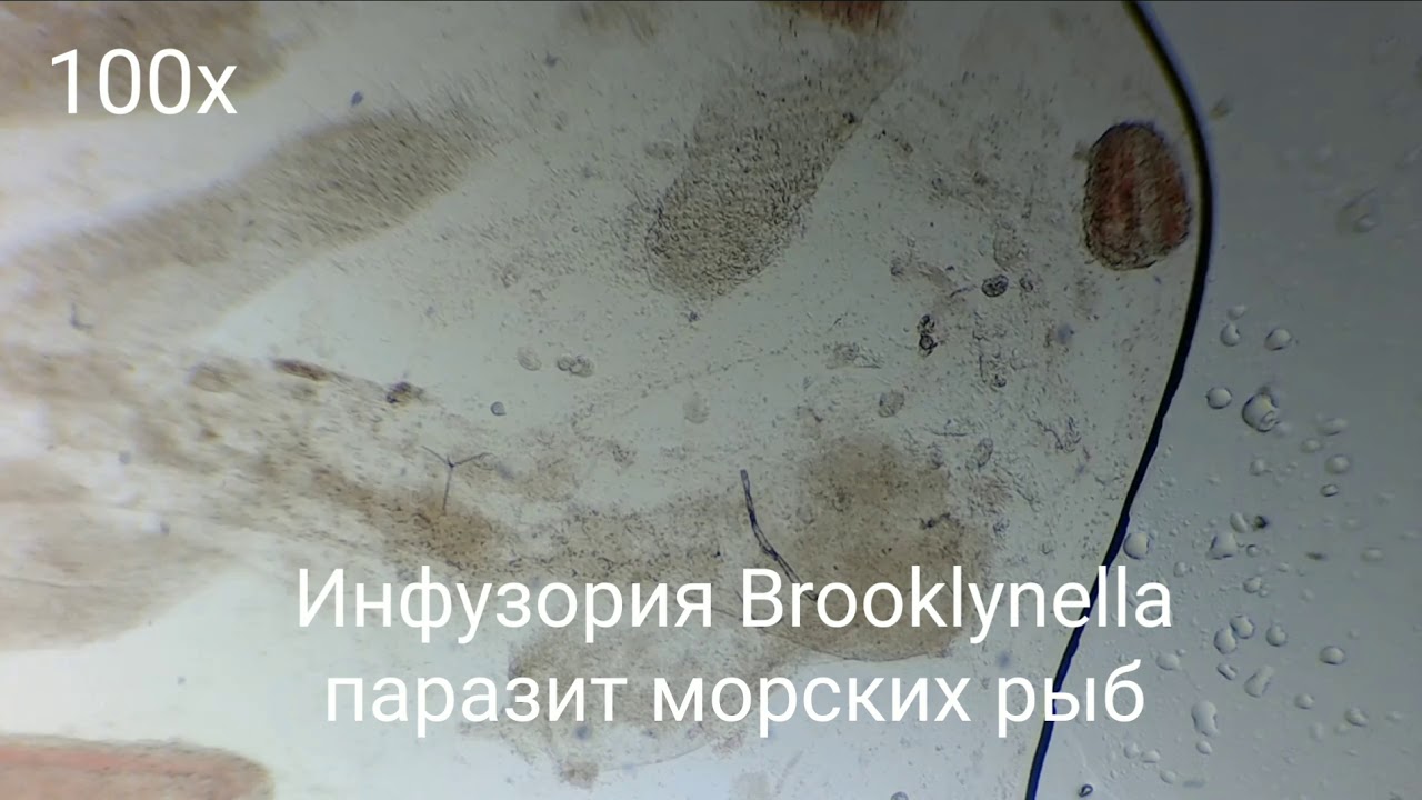 Brooklynella