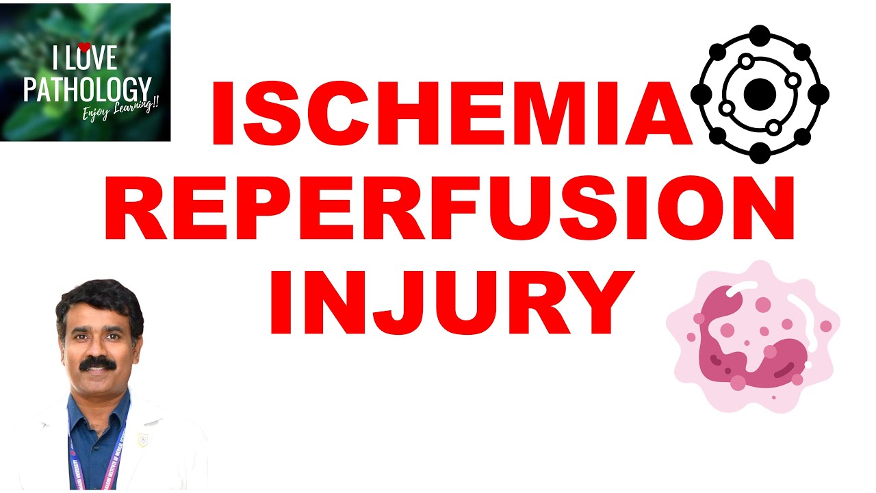 Ischemic heart disease  | part 4  | ISCHEMIA REPERFUSION INJURY | Pathogenesis | Prevention