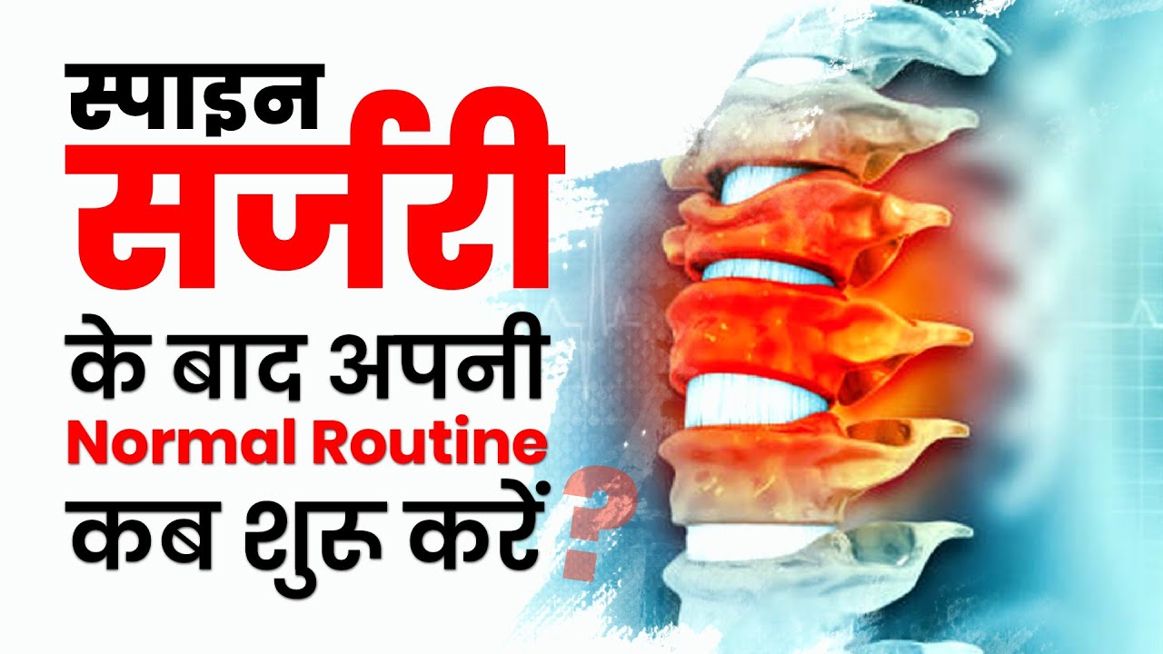 When To Start Your Daily Routine After Spine Surgery? Endoscopic Spine Surgeon In India-Dr Devashish