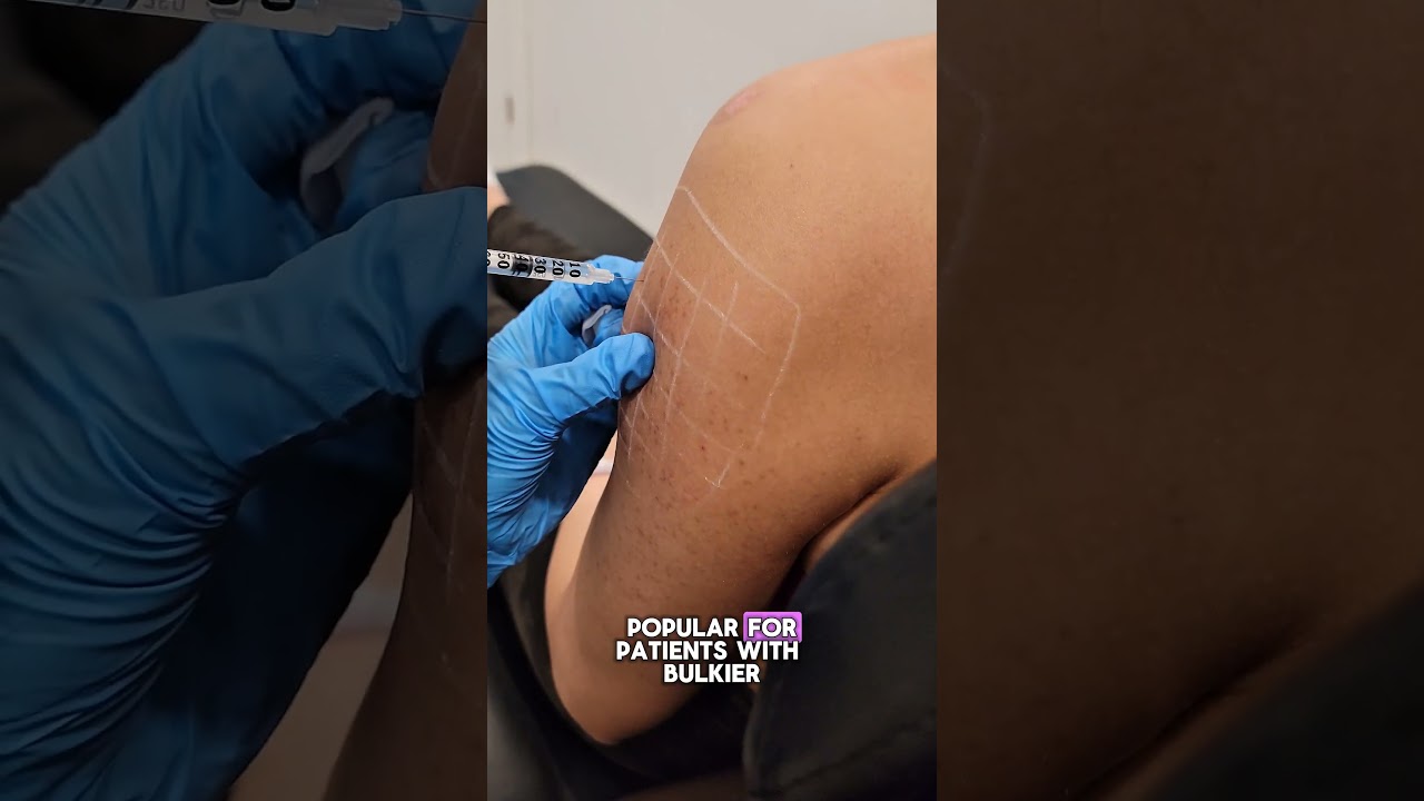 Hey Calgary, ready for barbie arm botox? #yycbotox #yyc #yycwomen #barbiearmbotox