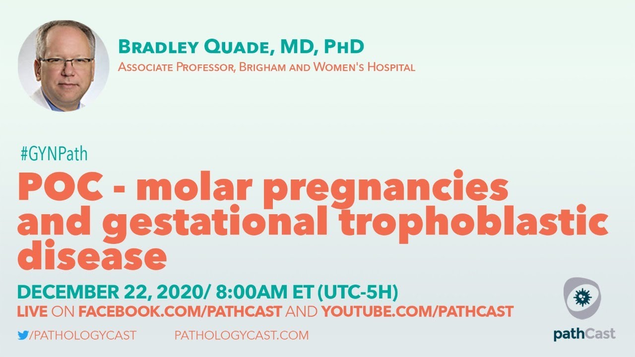 POC - molar pregnancies and gestational trophoblastic disease - Dr. Quade (BWH) #OBPATH