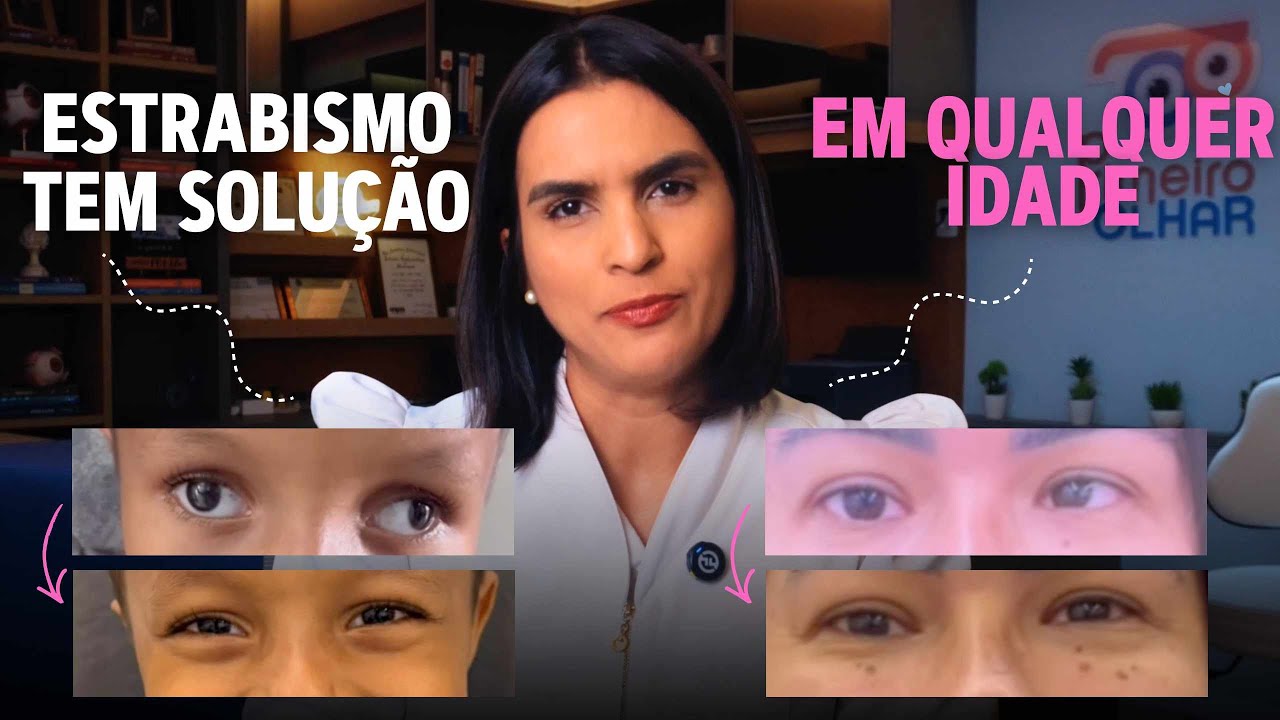 ESTRABISMO TEM SOLUÇÃO! EM QUALQUER IDADE!