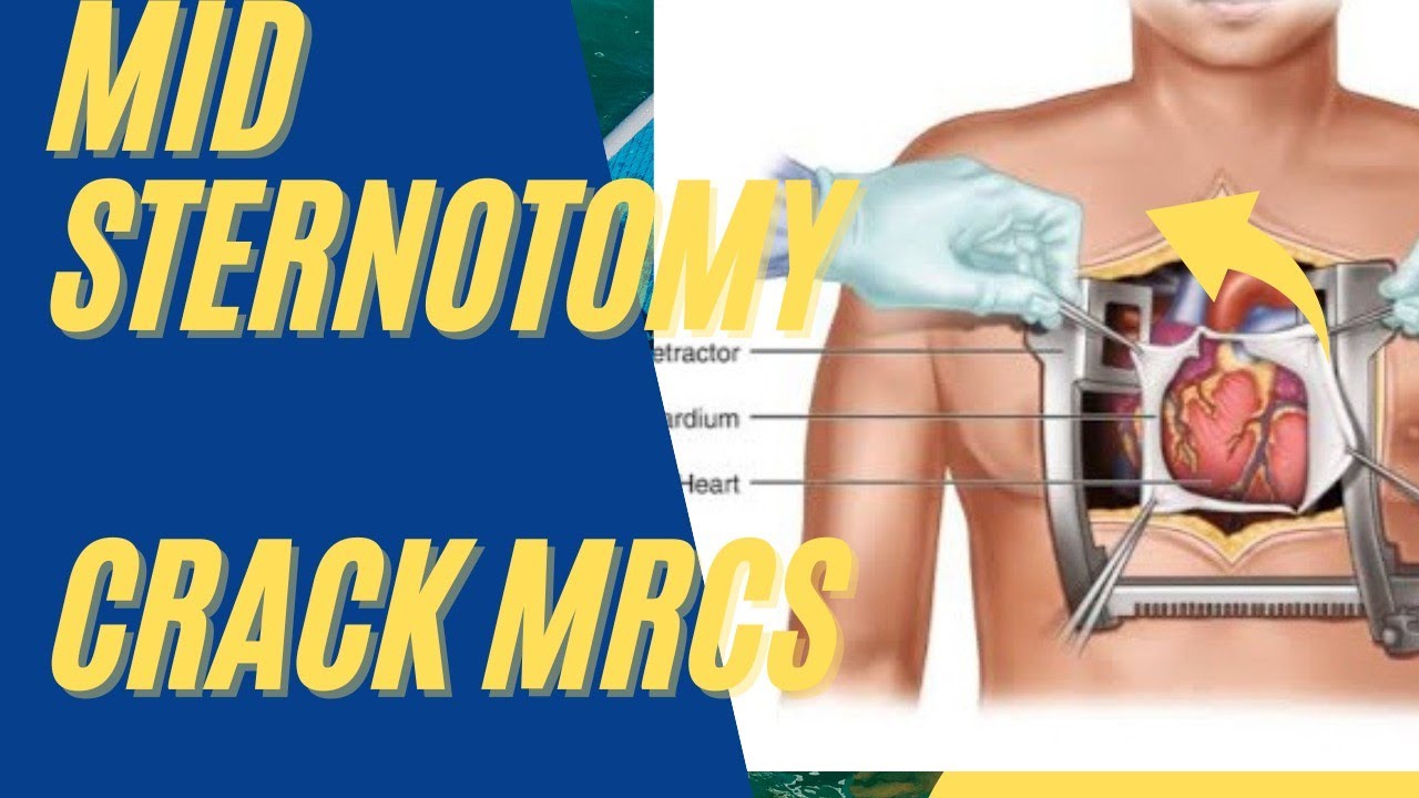Sternotomy incision MRCS question solve