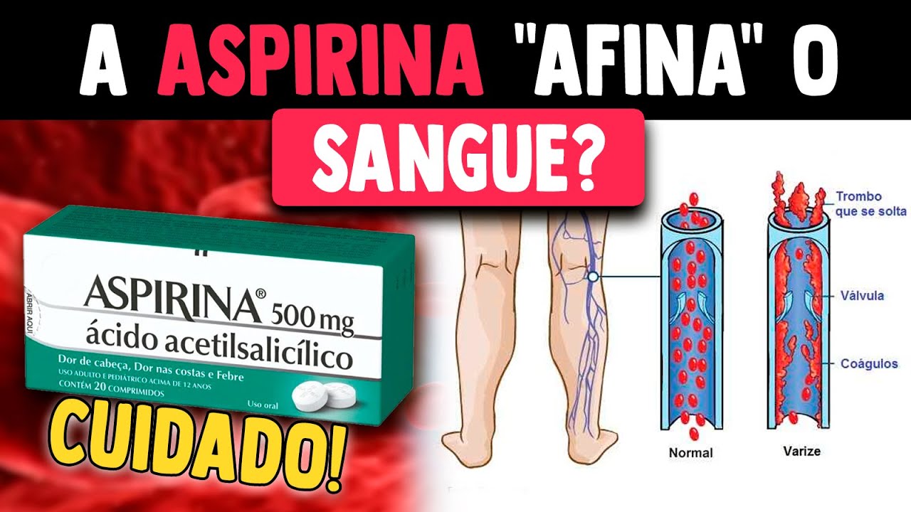 Aspirina (AAS) afina o sangue? É muito perigoso tomar AAS sem cuidado!