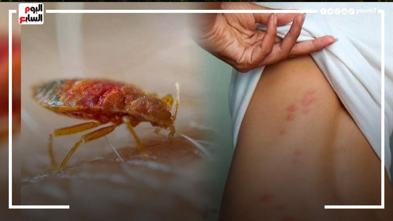 موسم الحشرة الأكثر خطورة وإزعاجا.. حشرة الفراش تسبب أمراض خطيرة تخلص منها فورا