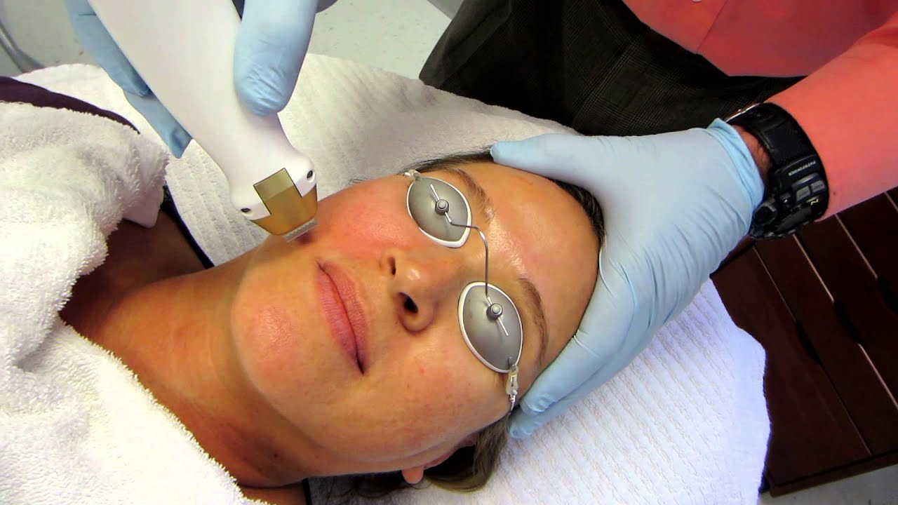 Sandra Fractional