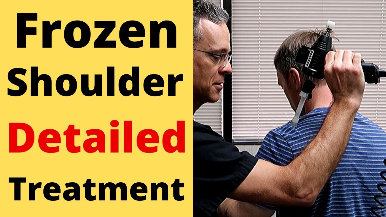 Frozen Shoulder: Very Detailed Treatment *MUST SEE*