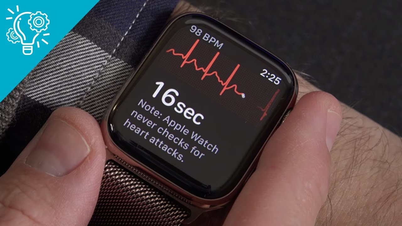 Top 5 Best Smartwatch with ECG