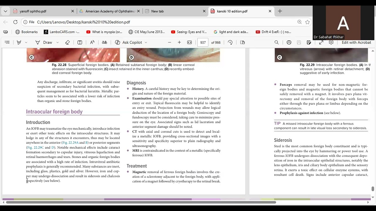 Lecture 1 chapter trauma(intraocular foreign bodies) 
