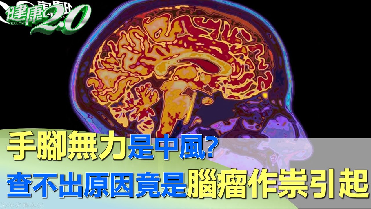 手腳無力是中風？ 查不出原因竟是腦瘤作祟引起 健康2.0