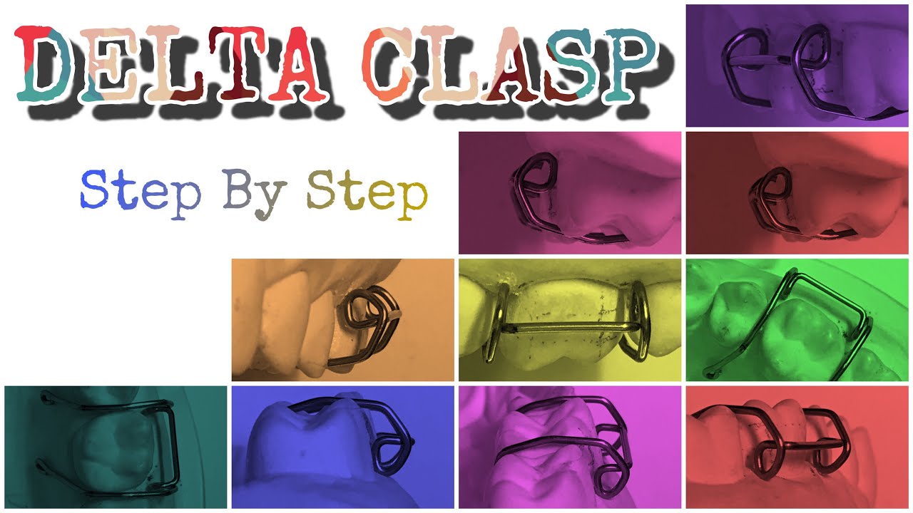 Delta Clasp||Fabrication Step By Step