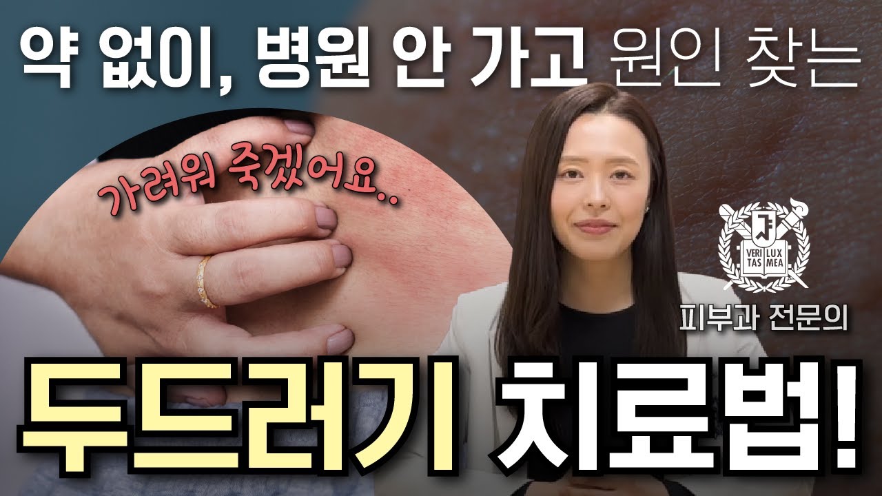 두드러기 원인과 치료법 | 가려움에 약만? 두드러기 가라앉히는법!