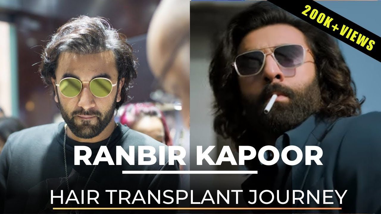 Ranbir Kapoor’s Hair Transplant Journey | Dr Nivedita dadu