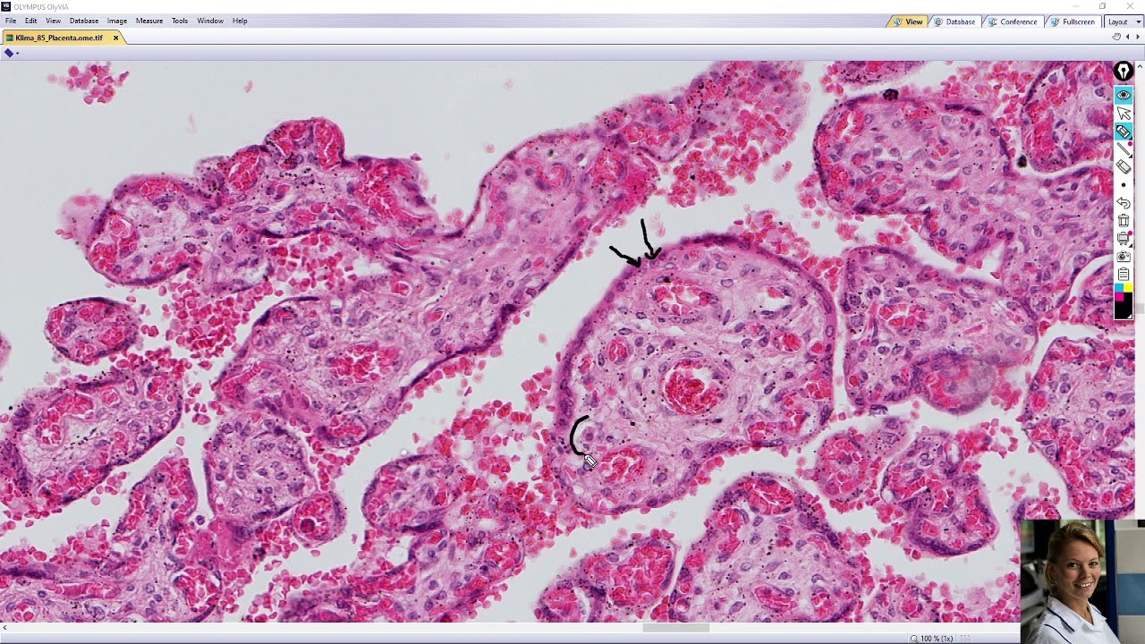 placenta