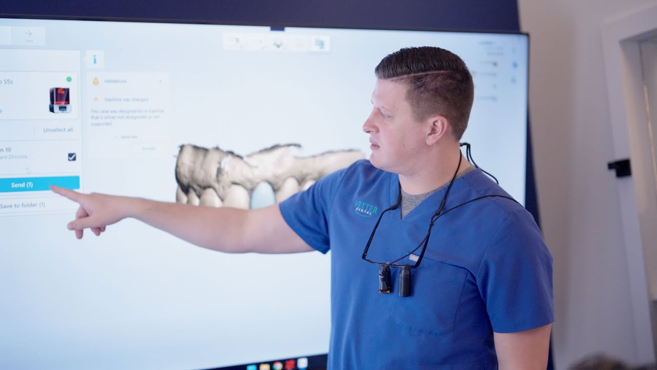 Dr. Austin Vetter shares his experience with 3Shape Automate crown in 3Shape Unite