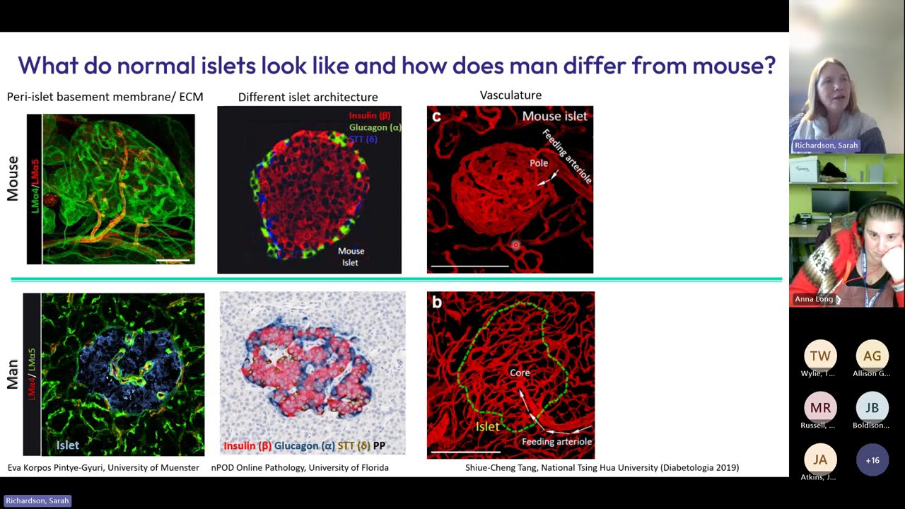 Understanding and Treatment of Type 1 Diabetes through New Insights from the Human Pancreas