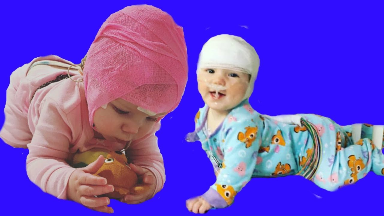 Baby Central Apnea Story