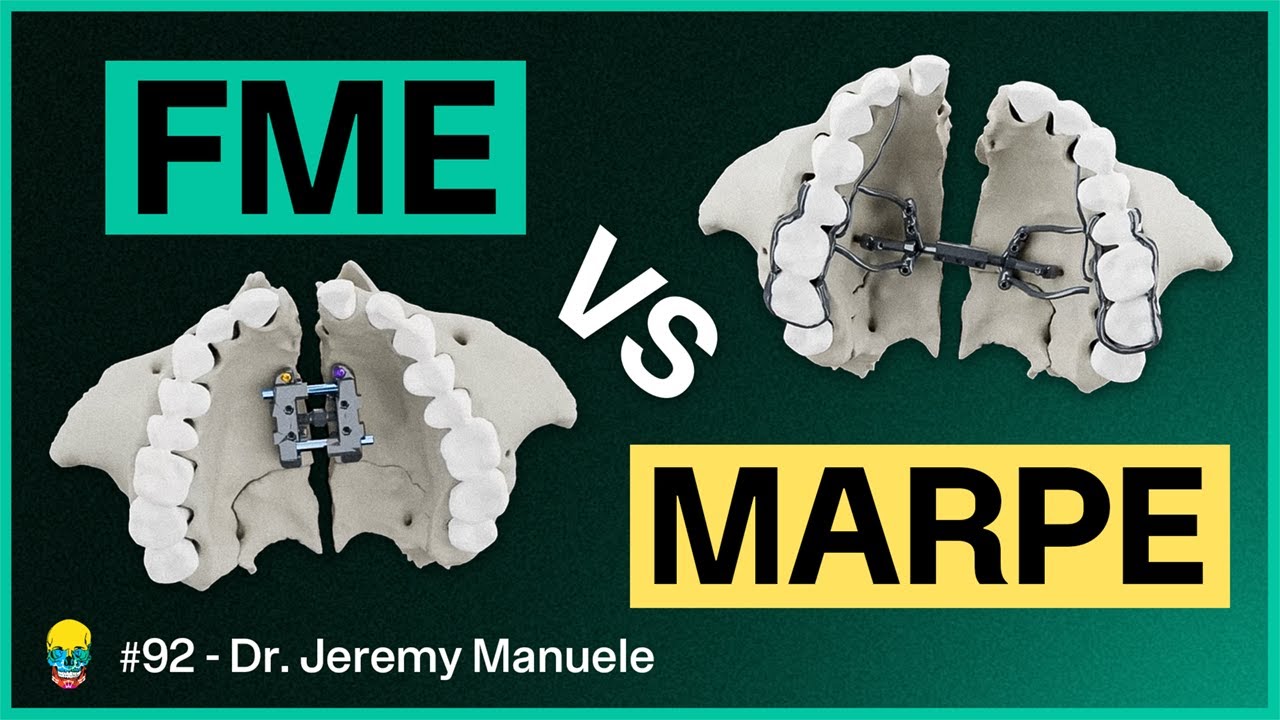 What REALLY Makes FME Special? Never Before Seen Images | Dr. Jeremy Manuele #92